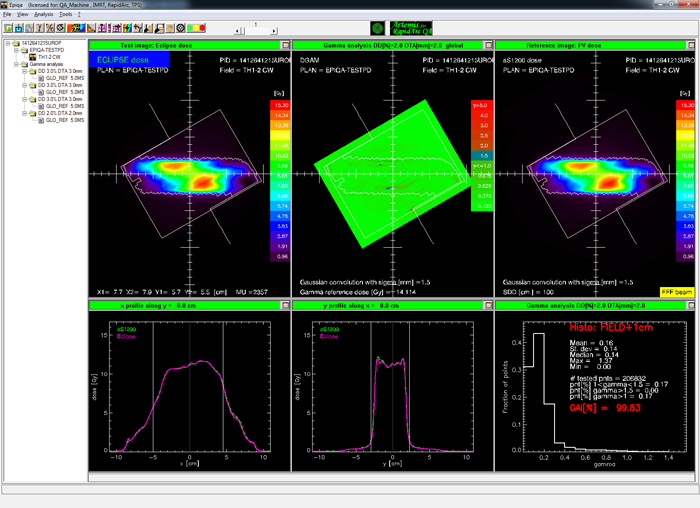 EPIQA Gamma analysis Field plus 1cm