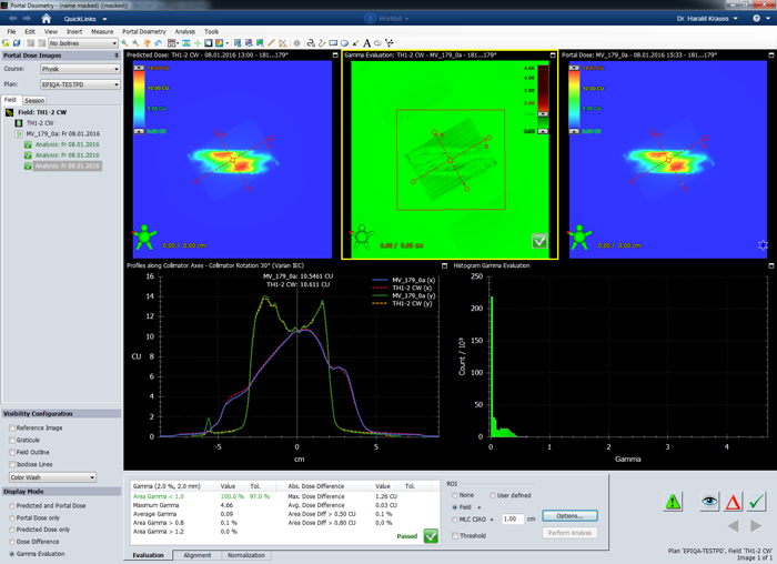 VPD Gamma analysis Field plus 1cm
