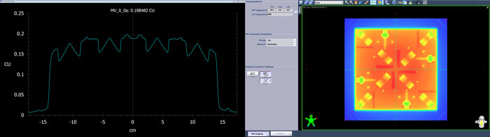 Measuring diagonal profile on the TrueBeam console