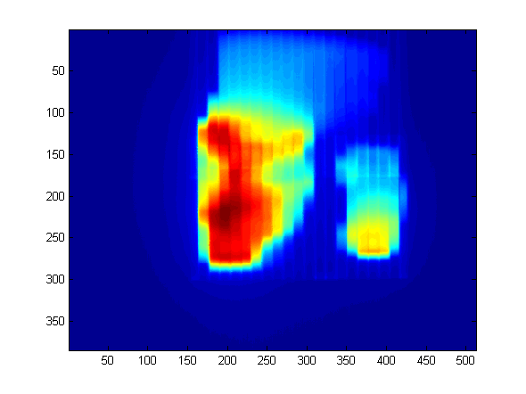 Predicted portal dose image of 320° field